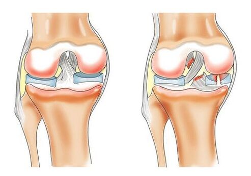 healthy knee and knee joint joints