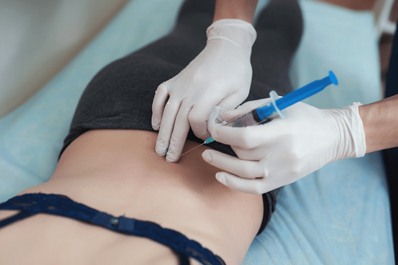 exclusion in lumbar osteochondrosis